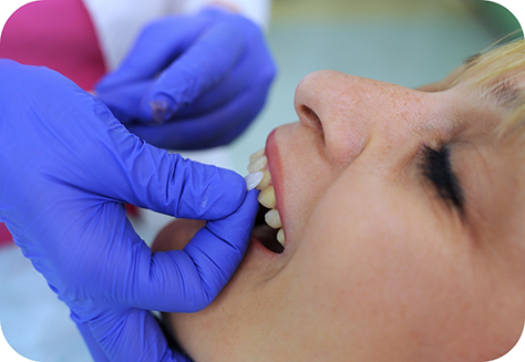 Dental patient having veneers placed