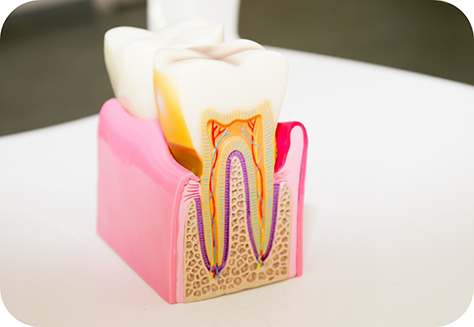 Model showing inside of tooth